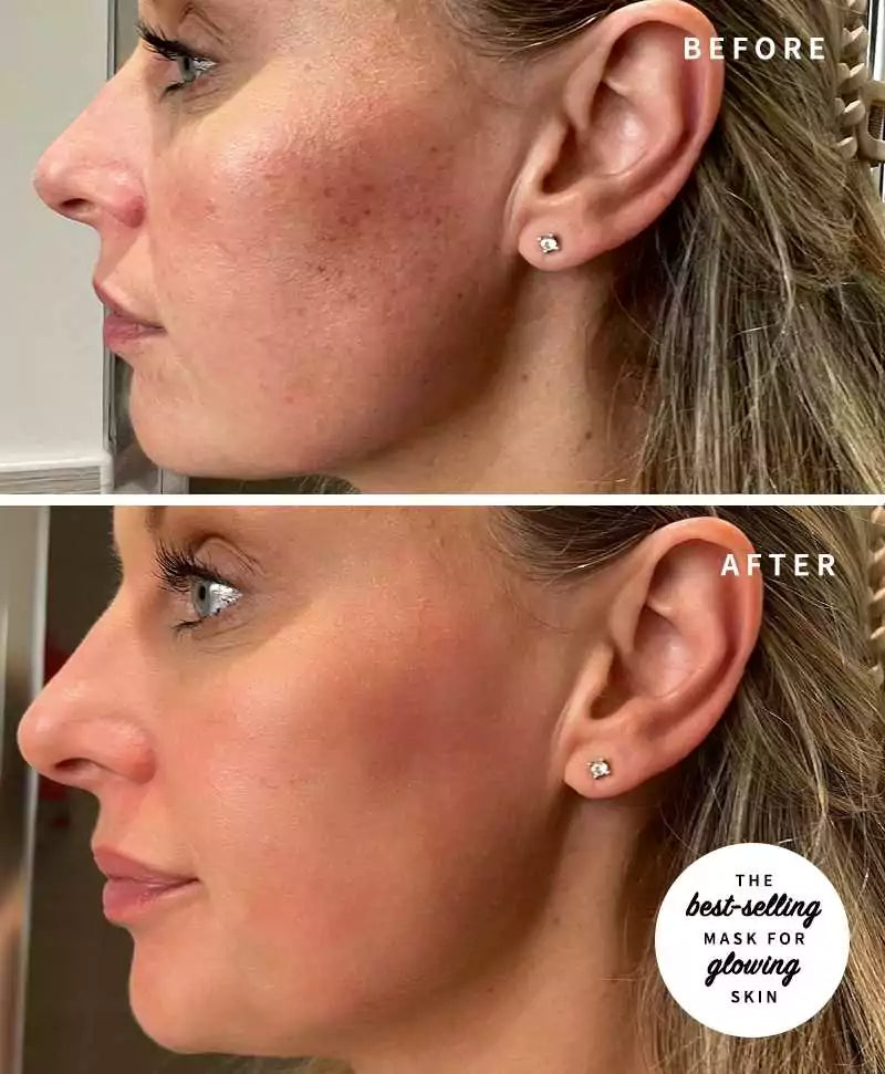 Summer Essentials Set