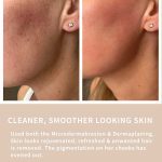 SENSSE Micro Derma Duo Cleaner Smoother Skin